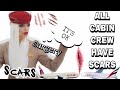 You can be a CABIN CREW with SCARS & SURGERIES| MUST WATCH | Emirates & Qatar Airways