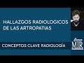 8 Hallazgos radiológicos de las artropatías