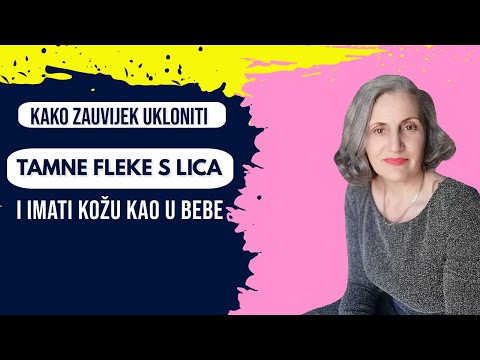 Video: Ne Propustite Svoju Priliku: U Ovom Kozmetičkom Salonu Možete Besplatno Riješiti Sve Probleme S Kožom Lica