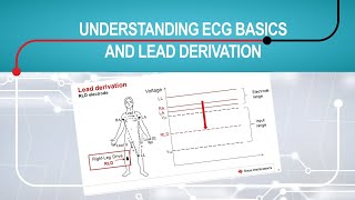 Understanding electrocardiogram (ECG) basics and lead derivation