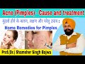 Acne pimples cause and treatment