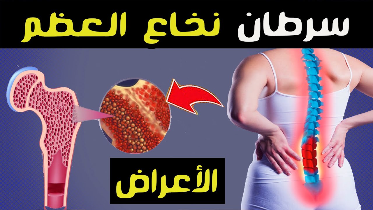 سرطان نخاع العظم : الأعراض