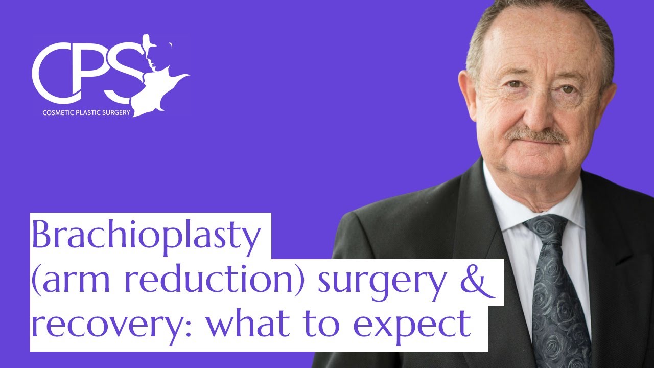 Brachioplasty (Arm Lift): Surgery, Recovery & What To Expect