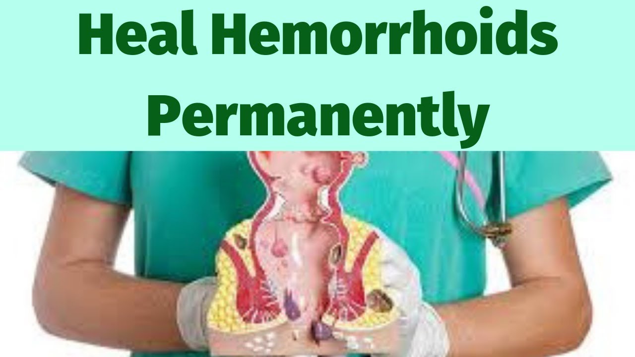 do i have hemorrhoids