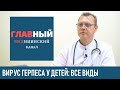 Герпес у детей: симптомы и лечение герпеса. Виды герпеса у ребенка, новорожденных и грудничка