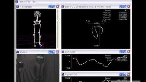 The MotionMonitor® - Accusway Limits of Stability