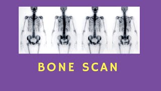 BONE SCAN | RADIOTHERPAY EDUTECH | NUCLEAR MEDICINE