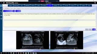 Entering Measurements screenshot 4