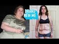 I Lost 250lbs, Now I’m Ready To Lose My Excess Skin | BRAND NEW ME