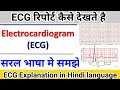 ECGレポートकैसेदेखतेहै||ヒンディー語での心電図の説明