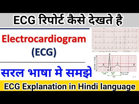 ईसीजी रिपोर्ट खराब है || इलेक्ट्रोकार्डियोग्राम व्याख्या हिंदी भाषा में