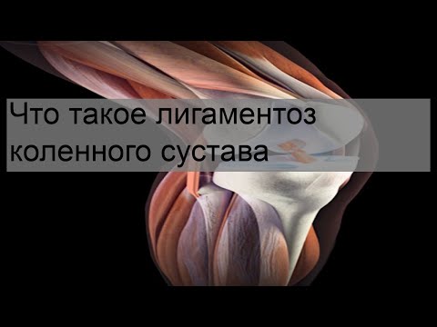 Что такое лигаментоз коленного сустава