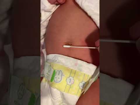 赤ちゃん おへそのお手入れ臍帯