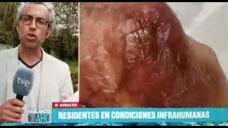Hablando claro: Imágenes inaceptables en la residencia pública más grande de Galicia (CRAPD Vigo I)