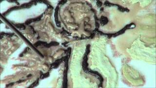 Relief Slip Painting