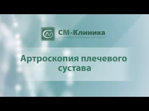 Артроскопия плечевого сустава – "СМ-Клиника"