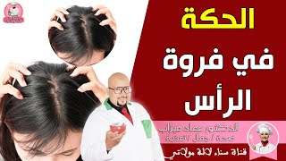 علاج الحكة في فروة الرأس مع الدكتور عماد ميزاب