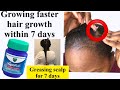 GREASING SCALP Everyday WITH VICKS VAPOUR RUB! 7 DAY CHALLENGE Vicks vapour rub for hair growth