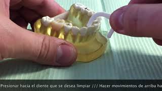 Hilo Dental: Convencional vs FLosser