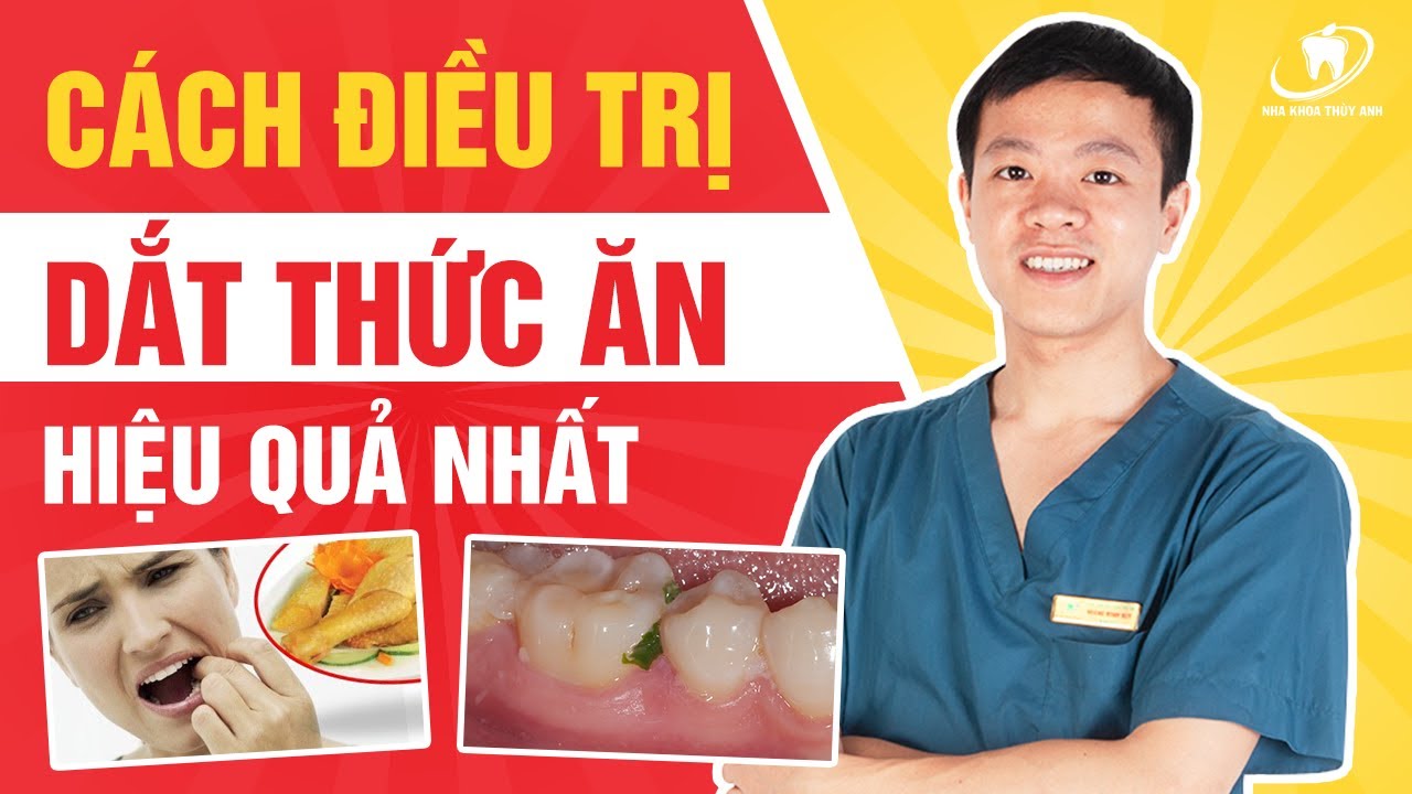 Outline Video Cách điều trị dắt thức ăn hiệu quả nhất.