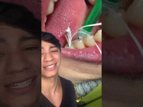 Vídeo: Como desenhar um dente se você não for artista ou estudante de odontologia