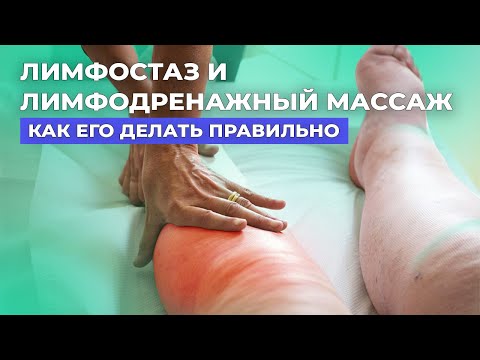 ПРАВИЛЬНЫЙ массаж при ЛИМФОСТАЗЕ. Показывает лимфолог