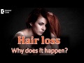 Important causes of hair loss  dr shashi kiran a r