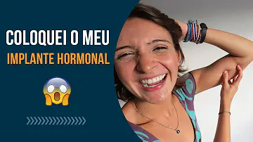 Qual o valor do implante hormonal?