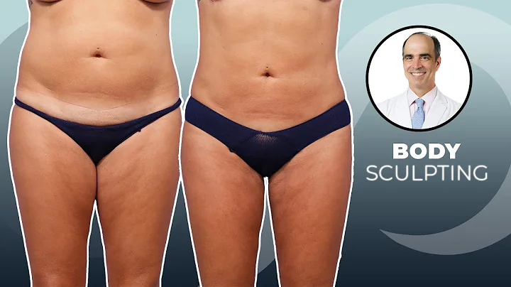 Dr. David Stoker: Female Body Sculpting Using Lipo