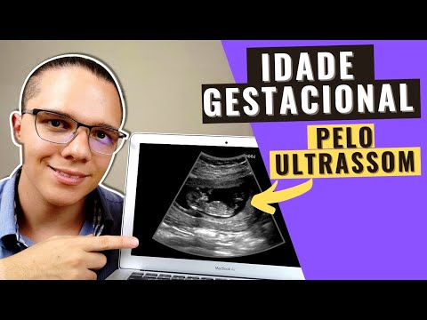 Vídeo: Como Determinar A Duração Da Gravidez Por Ultrassom