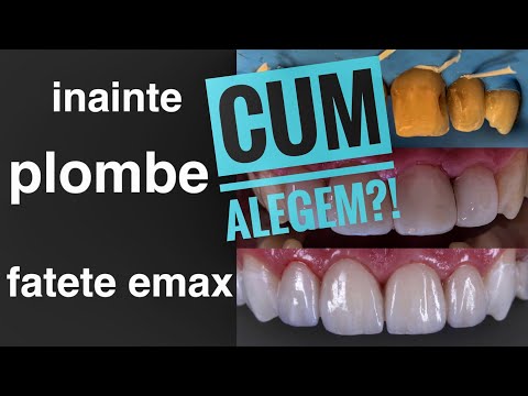 Video: Este Emax un zirconiu?