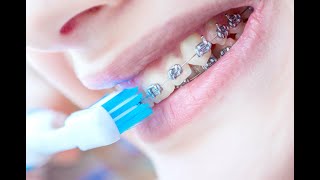 Ortodoncia Adn Dental