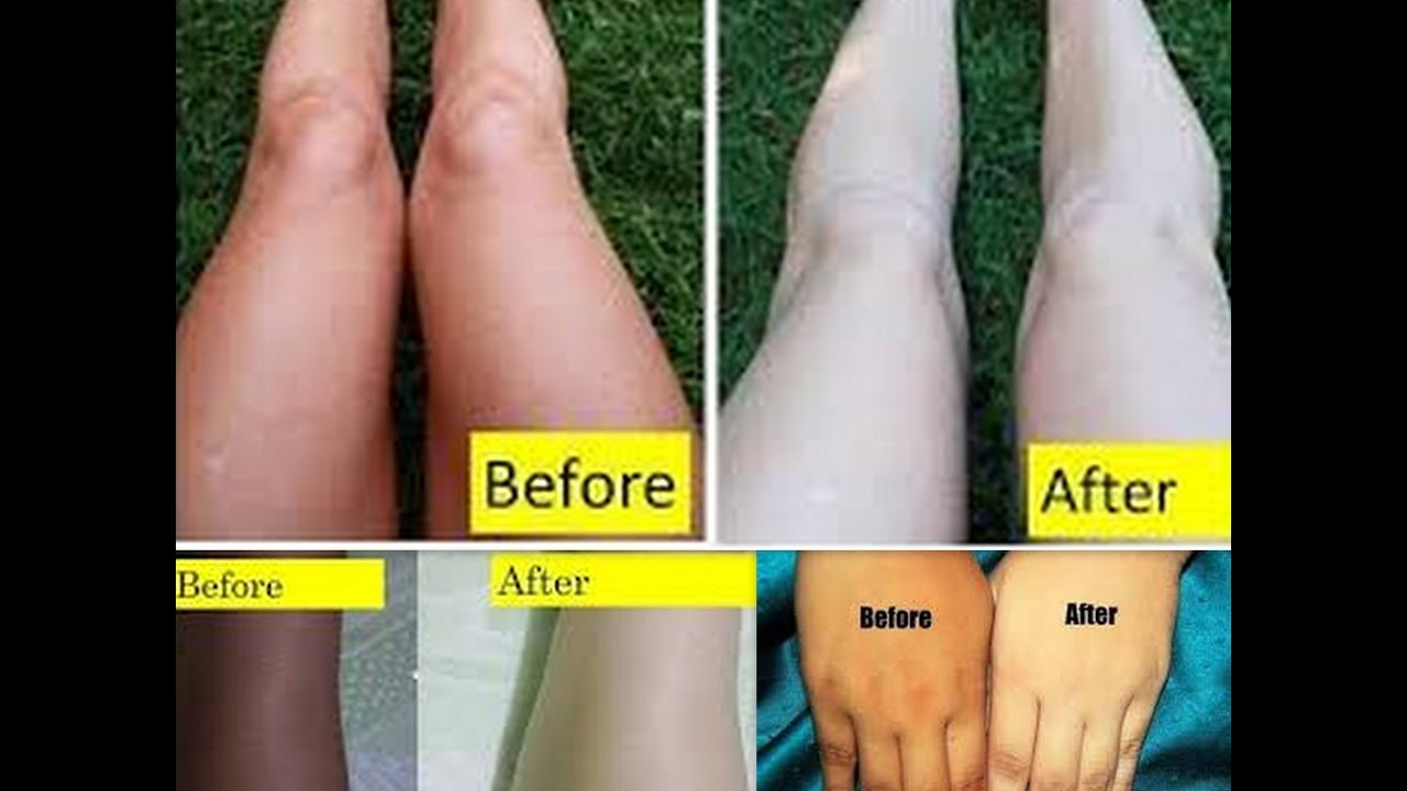 How To Lighten Your Dark Body Parts Instant Skin Lightening Diy