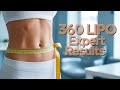Advanced 360° Liposuction Procedure Explained | Best 360 Liposuction Clinic in Hyderabad | Sculpt