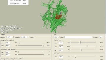 A video sequence demonstrating the DTI-Query software