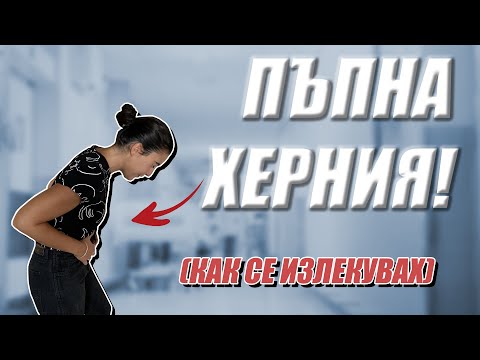 Моят опит с пъпната херния! Как се излекувах.