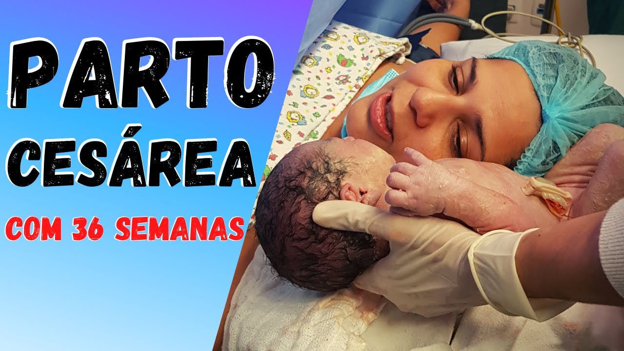 RELATO DE PARTO | CESÁREA COM 36 SEMANAS | PERDI LÍQUIDO AMNIÓTICO ...
