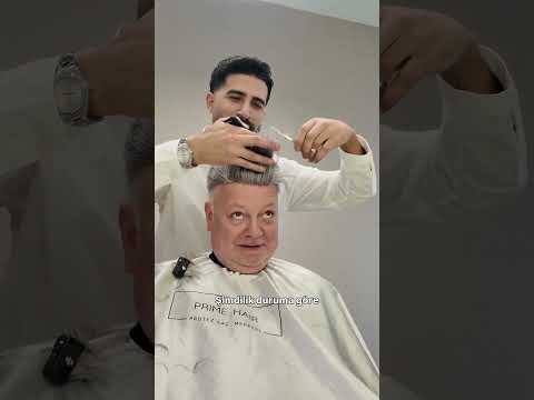 Protez saç yaptırdım. Nasıl olmuş?