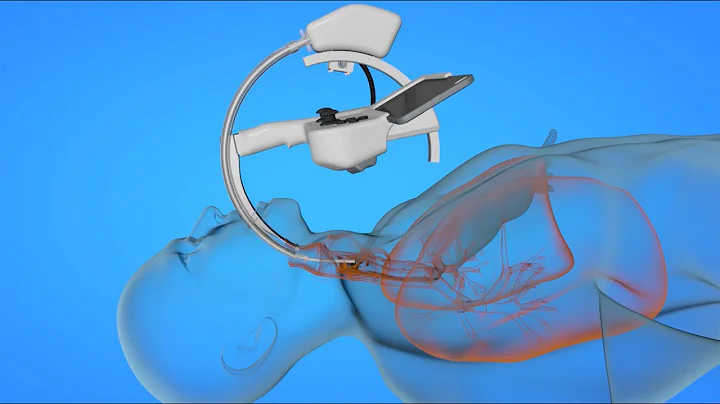 Sichere Intubation dank künstlicher Intelligenz und Robotik