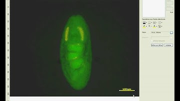 AxioVision - 6D - C (Post Traitement 2: Les annotations)