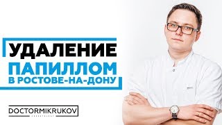 Удаление папиллом в Ростове-на-Дону #удалитьпапилломуростов