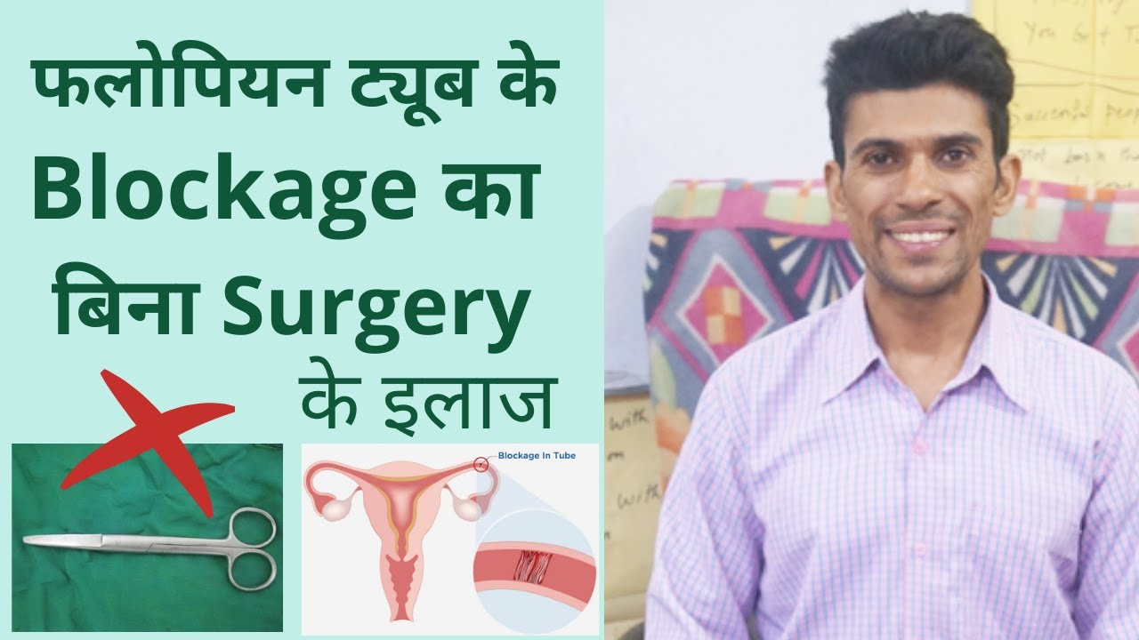 Fallopian Tube Blockage Treatment Without Surgery By Dr Vinod Kumar Fallopian Tube Blockage Treatment Without Surgery By Dr Vinod Kumar
