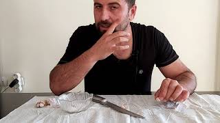 Saç Kıran Tedavisi Nasıl Olur.?