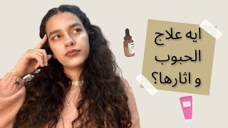 ACNE | ايه اسباب الحبوب وازاي اتجنب ظهورها وايه علاجها