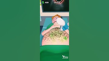 master doctor 3d stomach operation in animation level 6