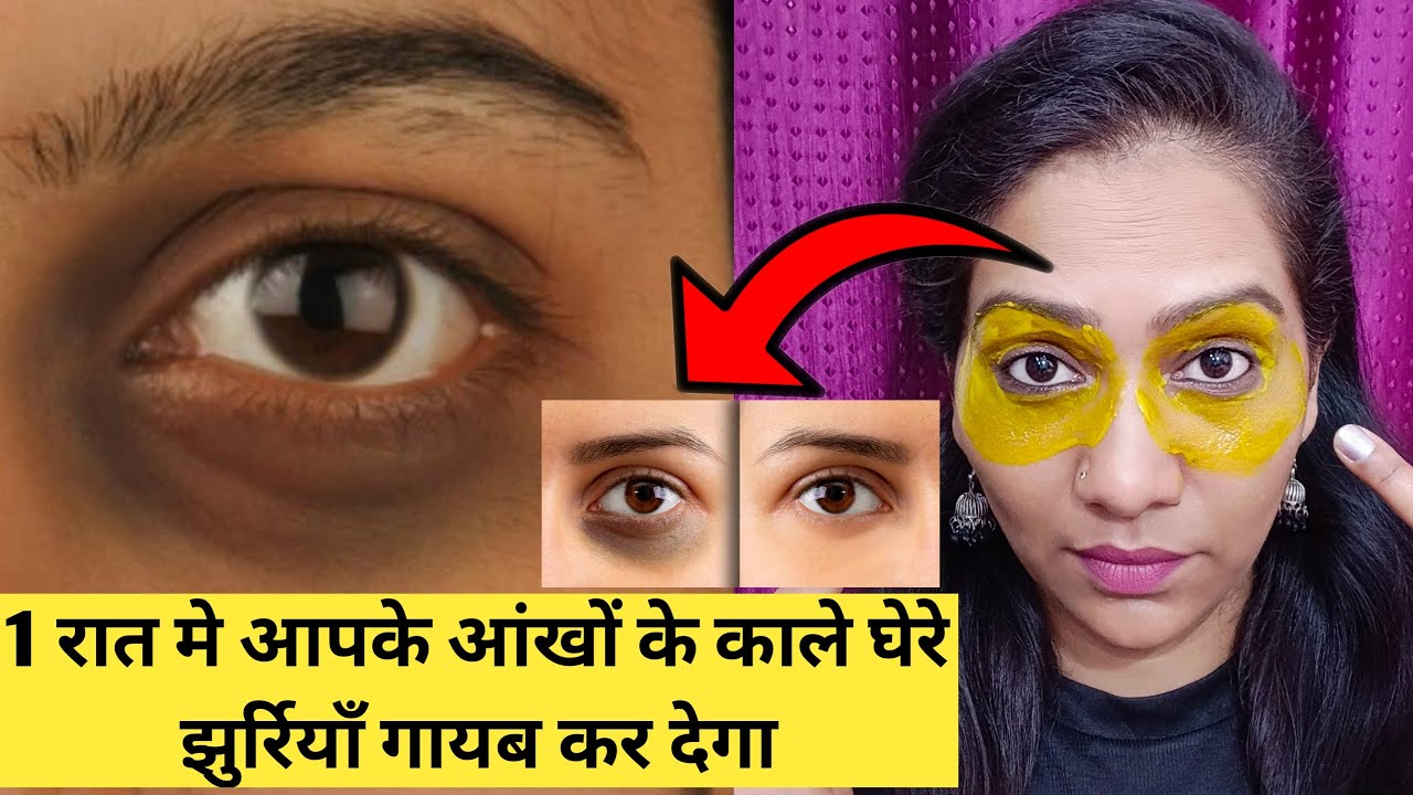 धंसी हुई आंखें🌿आंखों के नीचे गड्ढे,Dark circles & Wrinkles को कुछ दिन में  गायब करने का रामबाण नुस्खा - YouTube