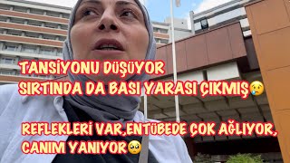 Tansi̇yonu Düşüyor,Sirtinda Da Basi Yarasi Çikmiş🥺Reflexleri̇ Var, Entübede Çok Ağliyor😢
