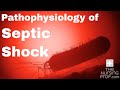 Pathophysiology of Septic Shock