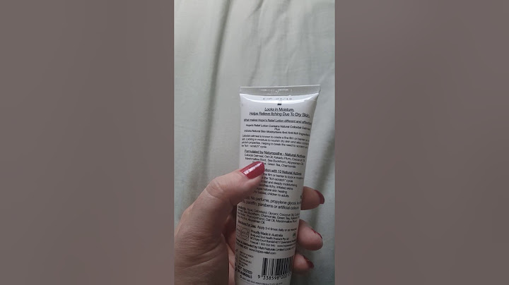 Hopes relief eczema cream review