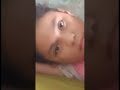 MUKA KETIKA LELAH PUASA CHECK